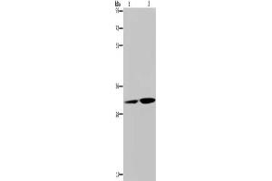 Gel: 8 % SDS-PAGE, Lysate: 40 μg, Lane 1-2: HT29 cells, human placenta tissue, Primary antibody: ABIN7129237(DNASE1L3 Antibody) at dilution 1/450, Secondary antibody: Goat anti rabbit IgG at 1/8000 dilution, Exposure time: 30 seconds (DNASE1L3 Antikörper)