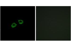 Immunofluorescence analysis of A549 cells, using ARFGEF2 Antibody.