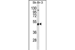 Western blot analysis in SK-BR-3 cell line lysates (35ug/lane). (WDR34 Antikörper  (AA 305-334))