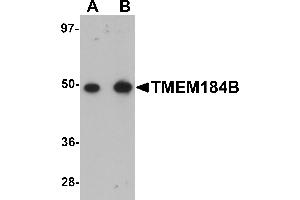 Western Blotting (WB) image for anti-Transmembrane Protein 184B (TMEM184B) (C-Term) antibody (ABIN1030751)