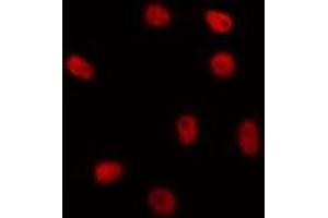 ABIN6267046 staining HepG2 by IF/ICC. (H1FOO Antikörper  (Internal Region))