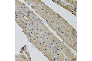 Immunohistochemistry of paraffin-embedded rat heart using ALDH9A1 antibody (ABIN5995392) (40x lens). (ALDH9A1 Antikörper)