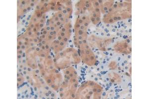 Used in DAB staining on fromalin fixed paraffin- embedded kidney tissue (EPB41 Antikörper  (AA 211-498))