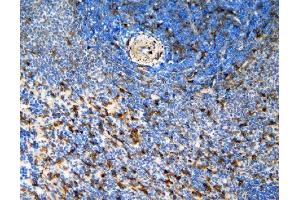 anti-Chemokine (C-C Motif) Receptor 6 (CCR6) (N-Term) antibody