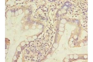 Immunohistochemistry of paraffin-embedded human small intestine tissue using ABIN7155745 at dilution of 1:100 (HOXC11 Antikörper  (AA 10-304))