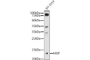 Western blot analysis of extracts of SH-SY5Y cells, using MGP antibody (ABIN6128268, ABIN6143825, ABIN6143826 and ABIN6221090) at 1:1000 dilution. (MGP Antikörper  (AA 20-103))