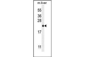 Western blot analysis of hCG_2024410 Antibody (C-term) in mouse liver tissue lysates (35ug/lane). (hCG_2024410 (AA 187-215), (C-Term) Antikörper)