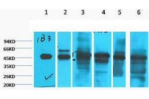 Western Blot (WB) analysis of 1) HepG2, 2) HeLa, 3) Mouse Liver tissue, 4) C2C12, 5) Rat Heart tissue, 6) Mouse Skeletal Muscle tissue, diluted at 1:2000. (Cytokeratin 18 Antikörper)