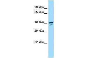 Western Blotting (WB) image for anti-Spermine Synthase, SMS (SMS) (Middle Region) antibody (ABIN2789346) (SMS Antikörper  (Middle Region))