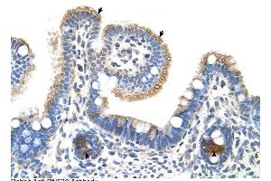 RNF39 antibody was used for immunohistochemistry at a concentration of 4-8 ug/ml to stain Epithelial cells of intestinal villus (arrows) and intestinal gland (arrows Heads) in Human Intestine. (RNF39 Antikörper  (N-Term))