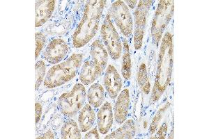 Immunohistochemistry of paraffin-embedded mouse kidney using THUMPD3 Rabbit pAb (ABIN6132951, ABIN6149133, ABIN6149134 and ABIN6214652) at dilution of 1:200 (40x lens). (THUMPD3 Antikörper  (AA 1-250))