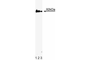 Western blot analysis of Stat3 on a A431 cell lysate (Human epithelial carcinoma, ATCC CRL-1555). (STAT3 Antikörper  (AA 1-175))