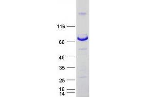 Western Blotting (WB) image for Myotubularin Related Protein 14 (MTMR14) (Transcript Variant 2) protein (Myc-DYKDDDDK Tag) (ABIN2726528)