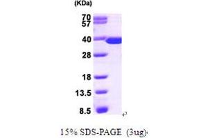 SDS-PAGE (SDS) image for Thymidylate Synthetase (TYMS) (AA 1-313) protein (His tag) (ABIN666924) (TYMS Protein (AA 1-313) (His tag))