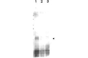 Western blot using  affinity purified anti-S. (Recombination Protein 107 (REC107) (pSer30) Antikörper)