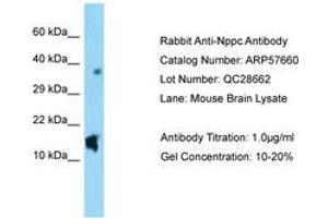 Image no. 1 for anti-Natriuretic Peptide Type C (NPPC) (AA 71-120) antibody (ABIN6749943)