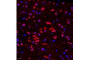 Immunofluorescence of paraffin embedded mouse brain using Rac3 (ABIN7075378) at dilution of 1:500 (400x lens) (RAC3 Antikörper)