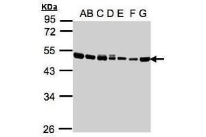 WB Image Sample(30μg whole cell lysate) A: 293T B: A431 , C: H1299 D: HeLa S3 , E: Hep G2 , F: MOLT4 , G: Raji , 10% SDS PAGE antibody diluted at 1:1000 (EEF1A2 Antikörper)