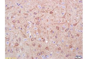 Formalin-fixed and paraffin embedded rat brain labeled with Rabbit Anti DDC/DOPA Decarboxylase Polyclonal Antibody, Unconjugated (ABIN725945) at 1:200 followed by conjugation to the secondary antibody and DAB staining (DDC Antikörper  (AA 201-300))