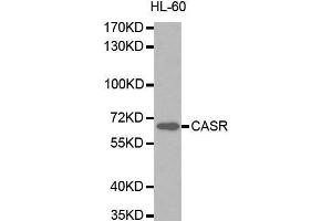 CASR anticorps  (AA 874-1088)