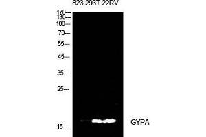 Western Blot (WB) analysis of 823, 293T, 22RV cells using CD235a Polyclonal Antibody. (CD235a/GYPA Antikörper  (Internal Region))