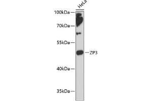 Western blot analysis of extracts of HeLa cells, using ZP3 antibody (ABIN6134464, ABIN6150536, ABIN6150538 and ABIN6217045) at 1:3000 dilution. (Zona Pellucida Glycoprotein 3 Antikörper  (AA 250-350))
