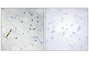 Immunohistochemistry analysis of paraffin-embedded human brain tissue using TCF3 antibody. (TCF3 Antikörper  (C-Term))