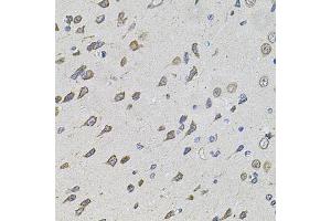 Immunohistochemistry of paraffin-embedded rat brain using FOXO3 antibody (ABIN5974623) at dilution of 1/100 (40x lens). (FOXO3 Antikörper)