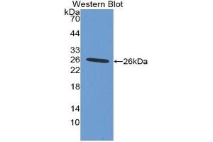 Western Blotting (WB) image for anti-Integrin, alpha X (Complement Component 3 Receptor 4 Subunit) (ITGAX) (AA 143-344) antibody (ABIN7442906)