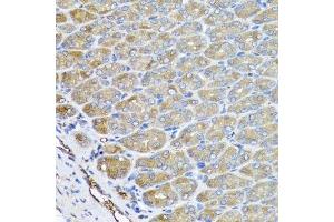 Immunohistochemistry of paraffin-embedded mouse stomach using VPS37A antibody. (VPS37A Antikörper  (AA 224-397))