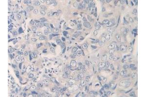 Used in DAB staining on fromalin fixed paraffin- embedded kidney tissue (IL12A Antikörper  (AA 23-219))