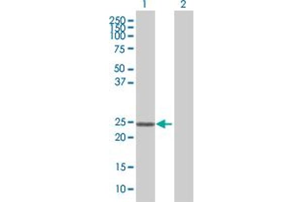 Zinc Finger Protein 22 Antikörper  (AA 1-224)