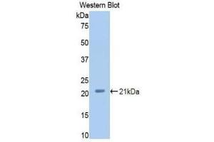 Western Blotting (WB) image for anti-Complement Factor P (CFP) (AA 54-217) antibody (ABIN1858389) (CFP Antikörper  (AA 54-217))