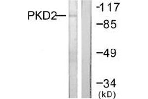 Western blot analysis of extracts from NIH-3T3 cells, treated with PMA 250ng/ml 15', using PKD2 (Ab-876) Antibody.