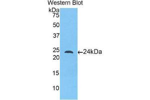 Western Blotting (WB) image for anti-Toll-Like Receptor 5 (TLR5) (AA 46-205) antibody (ABIN1175326)