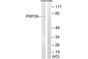 Western blot analysis of extracts from K562 cells, using PRPF39 antibody. (PRPF39 Antikörper  (Internal Region))