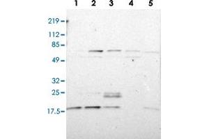 Western blot analysis of Lane 1: RT-4, Lane 2: U-251 MG, Lane 3: A-431, Lane 4: Liver, Lane 5: Tonsil with ATF3 polyclonal antibody  at 1:100-1:250 dilution.