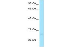 Image no. 1 for anti-RAB11A, Member RAS Oncogene Family (RAB11A) (C-Term) antibody (ABIN6748461) (RAB11A Antikörper  (C-Term))