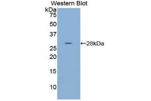Western blot analysis of the recombinant protein. (WARS Antikörper  (AA 140-347))
