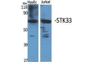 Western Blot (WB) analysis of specific cells using STK33 Polyclonal Antibody.