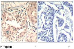 Image no. 2 for anti-Cyclin-Dependent Kinase 6 (CDK6) (pTyr13) antibody (ABIN401596) (CDK6 Antikörper  (pTyr13))