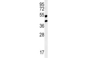Western blot analysis of AGER / RAGE in mouse lung tissue lysate.