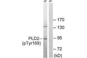 Western blot analysis of extracts from Jurkat cells treated with TNF using PLD2 (Phospho-Tyr169) Antibody. (Phospholipase D2 Antikörper  (pTyr169))