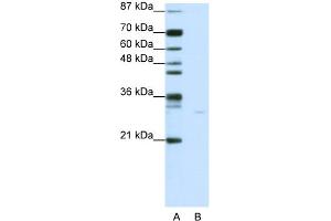 WB Suggested Anti-PDCD8 Antibody Titration:  0. (AIF Antikörper  (C-Term))