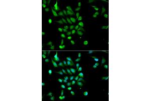 Immunofluorescence analysis of MCF-7 cells using PSMC5 antibody (ABIN5970727). (PSMC5 Antikörper)