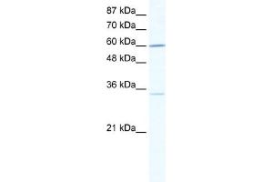 WB Suggested Anti-ZNF668 Antibody Titration:  0. (ZNF668 Antikörper  (N-Term))