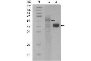 Western blot analysis using PAR4 mouse mAb against full-length Trx-Par4 recombinant protein (1) and Hela cell lysate (2).