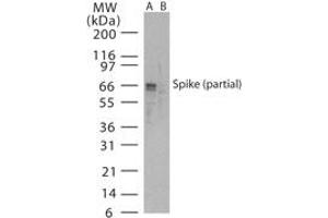Image no. 1 for anti-SARS-Coronavirus Spike Protein (SARS-CoV S) (AA 288-303) antibody (ABIN199981) (SARS-CoV Spike Antikörper  (AA 288-303))