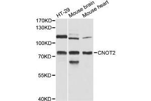 Western blot analysis of extracts of various cell lines, using CNOT2 antibody (ABIN6290147) at 1:3000 dilution. (CNOT2 Antikörper)
