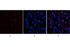 Immunofluorescence analysis of human liver cancer tissue.